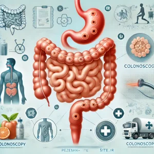 پولیپ روده و روش‌های تشخیص آن
