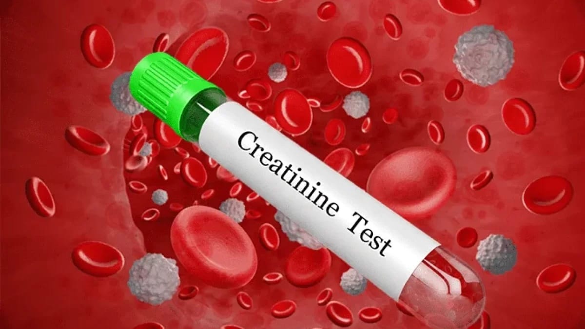 دلایل افزایش کراتینین در آزمایش خون+اینفوگرافیک