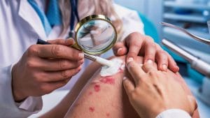 5 نشانه زخم غیر عادی