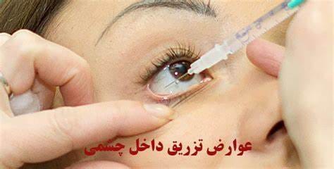 با تزریق چشمی خداحافظی کنید