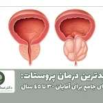 جدیدترین درمان پروستات راهنمای جامع برای آقایان 30 تا 45 سال