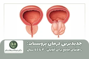 جدیدترین درمان پروستات راهنمای جامع برای آقایان 30 تا 45 سال
