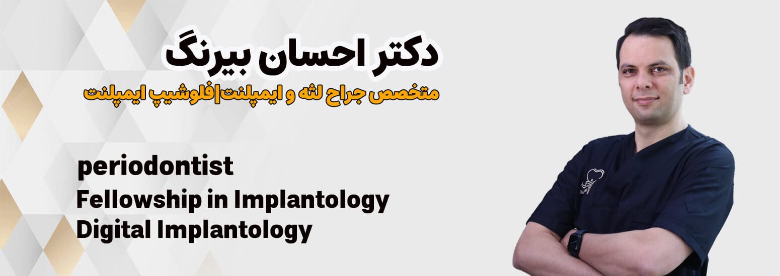 دکتر احسان بیرنگ، متخصص ایمپلنت دندان در تهران