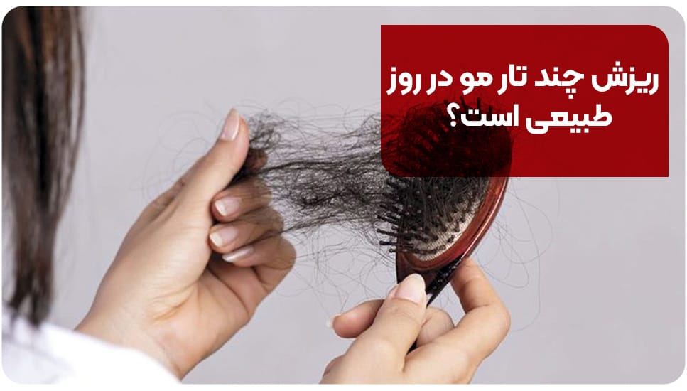 ریزش چند تار مو در روز طبیعی است؟ [+۱۰ دلیل ریزش مو]