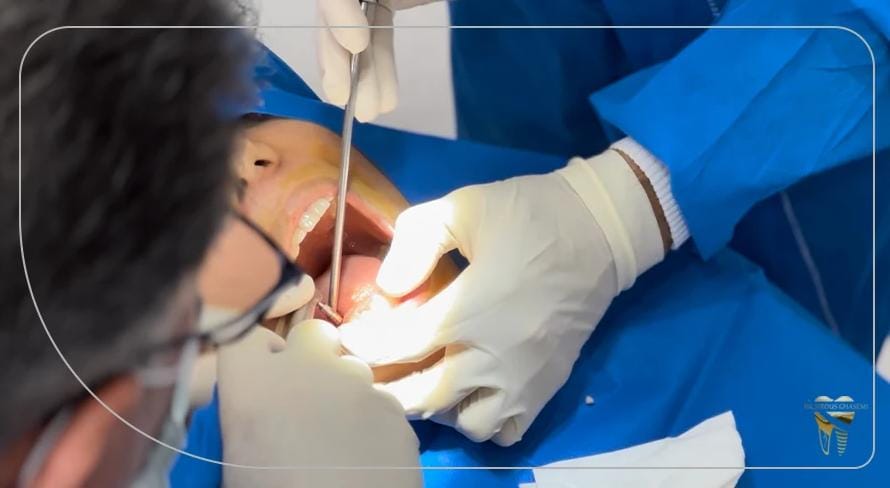 کاندیداهای مناسب برای ایمپلنت دیجیتال در شیراز