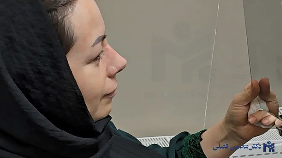 رازهای عمل بینی موفق