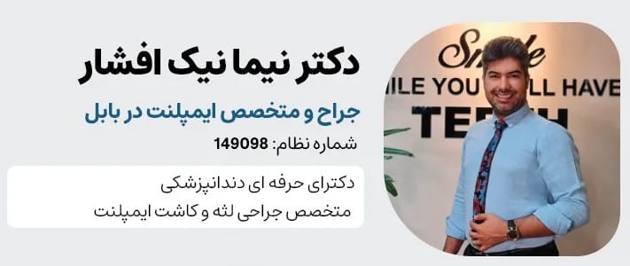 لیست بهترین متخصصان ایمپلنت در بابل