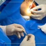 مزایای ایمپلنت دیجیتال به نقل از بهترین دکتر ایمپلنت دیجیتال در شیراز