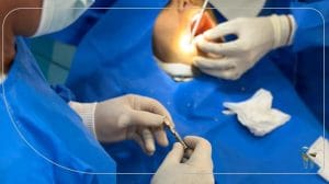 مزایای ایمپلنت دیجیتال به نقل از بهترین دکتر ایمپلنت دیجیتال در شیراز