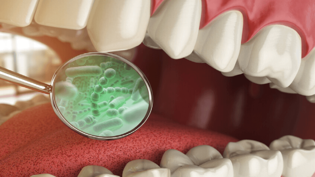 نقش دندان خراب در حملات قلبی کشف شد