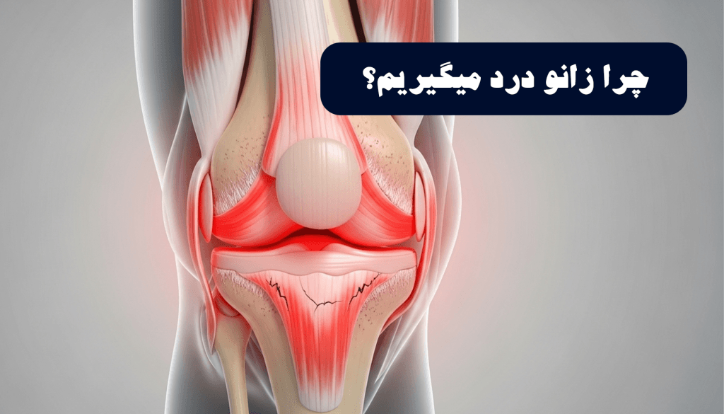 چرا زانو درد میگیریم