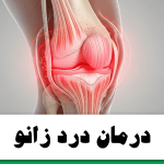 چرا زانو درد میگیریم
