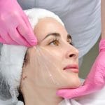 لیفت صورت با نخ آپتوس: روشی نوین برای جوانسازی طبیعی با دکتر فرزان نقشوار