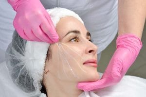 لیفت صورت با نخ آپتوس: روشی نوین برای جوانسازی طبیعی با دکتر فرزان نقشوار