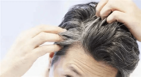 راهکارهای مقابله با سفیدی زودرس موها+اینفوگرافی