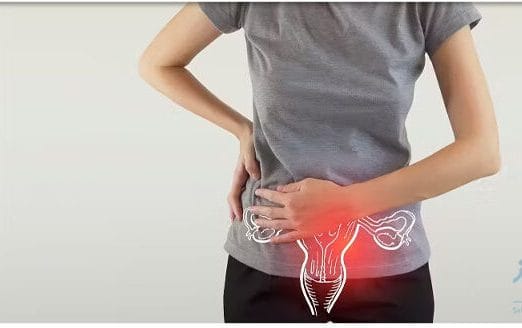 شناسایی مولکول F2R؛ امیدی تازه برای درمان سرطان تخمدان