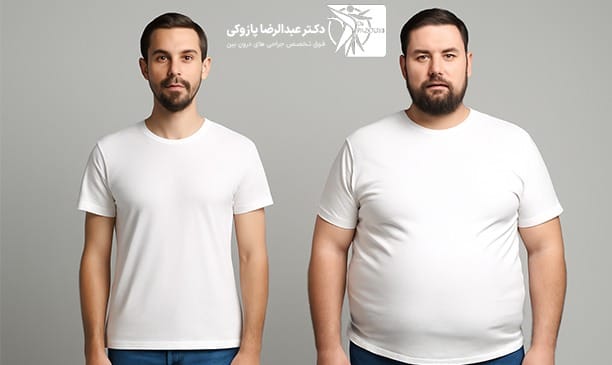 روش های لاغر کردن