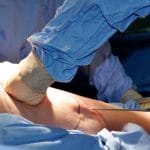 Liposuction: Uses, benefits, and risks