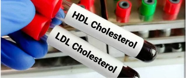 ارتباط LDL پایین با افزایش خطر دیابت نوع ۲