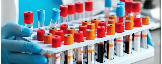 چه زمانی آزمایش خون ضروری است؟