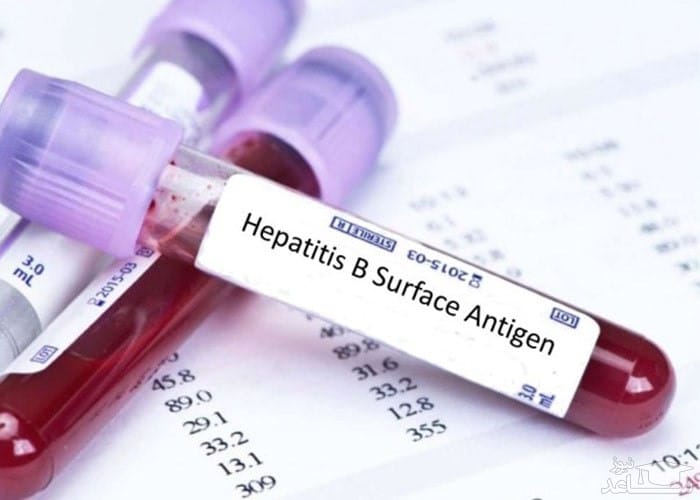 در صورت درمان نشدن هپاتیت B یا C این بلاها سر کبد می آید