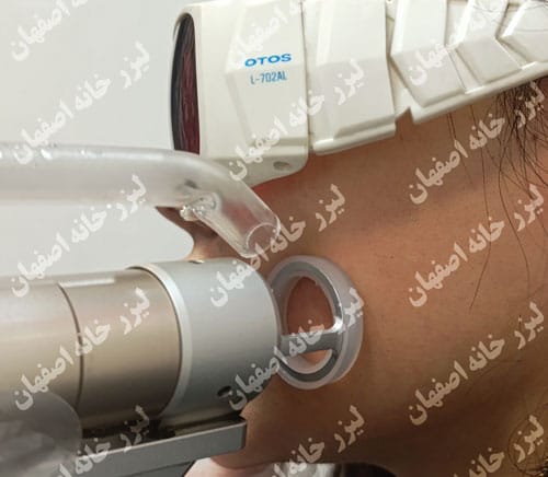 لیزر ارزان در خانه اصفهان