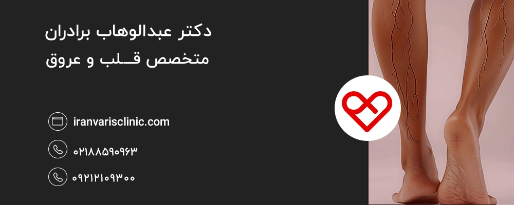 خواص سیر برای واریس | درمان طبیعی واریس پا با سیر