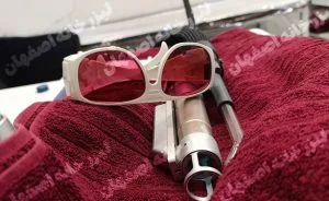 لیزر ارزان در اصفهان