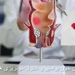 بواسیر خونی