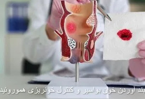 بواسیر خونی