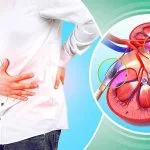 بهترین روش های درمان سنگ کلیه بدون عمل