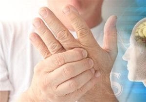 طب ایرانی مکمل درمان ام‌اس است، نه جایگزین آن