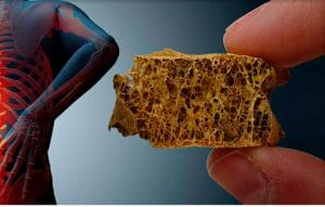 چگونه مانع پوک شدن استخوانها شویم؟