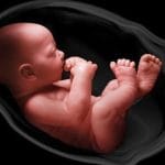 وجود ۲ میلیون بیمار مبتلا به مننوگسل در کشور/ شیوع بیماری در شهرهای گرمسیری بیشتر است