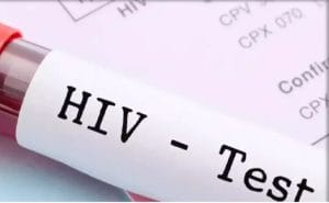 ۸ راهکار ساده و مؤثر برای پیشگیری از ابتلا به HIV