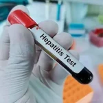 کبدت را بشناس/ هپاتیت فقط یک ویروس نیست!