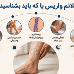 واریس و بی حسی پا