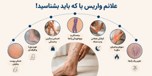 واریس و بی حسی پا