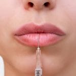 بعد از تزریق ژل لب چکار کنیم که ماندگاری آن بیشتر شود؟ ۱۰ راز افزایش دوام فیلر لب که کمتر کسی به شما می‌گوید
