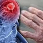 این نشانه‌ها از ابتلای جوانان به پارکینسون خبر می‌دهد؟