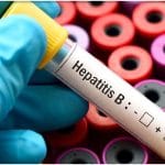 هپاتیت B همیشه با زردی شروع نمی‌شود/ اهمیت تشخیص زودهنگام را جدی بگیرید