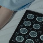 کشف یک ریتم مغزی پنهان که می‌تواند تنظیم تحریک عمقی مغز در پارکینسون را دقیق‌تر کند
