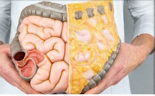 آمار خطرناک چربی خون ایرانی‌ها