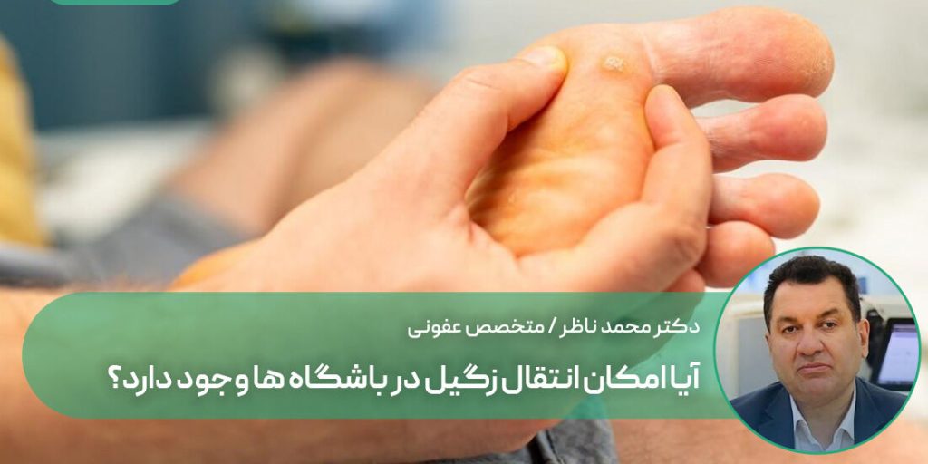 آیا امکان انتقال زگیل در باشگاه ها وجود دارد؟