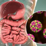 تفاوت مسمومیت غذایی با ویروس معده