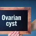 چگونه می توان کیست تخمدان را درمان کرد
