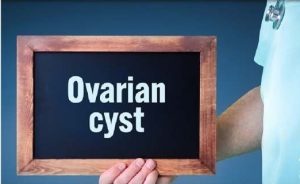 چگونه می توان کیست تخمدان را درمان کرد