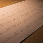 تله‌کینزی درونی: چگونه تمرکز ذهن و تکنیک‌های تنفسی می‌توانند ضربان قلب و استرس را تحت تأثیر قرار دهند