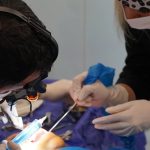 ایمپلنت دندان درکلینیک دکتر جوادیان