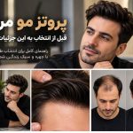 پروتز مو مردانه؛ قبل از انتخاب به این جزئیات توجه کنید
